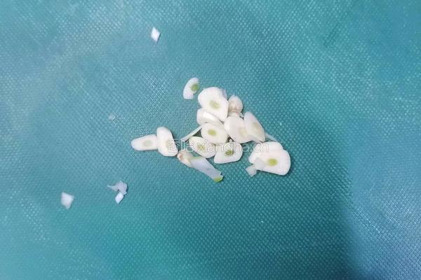 菠菜鸡蛋汤的做法图解3